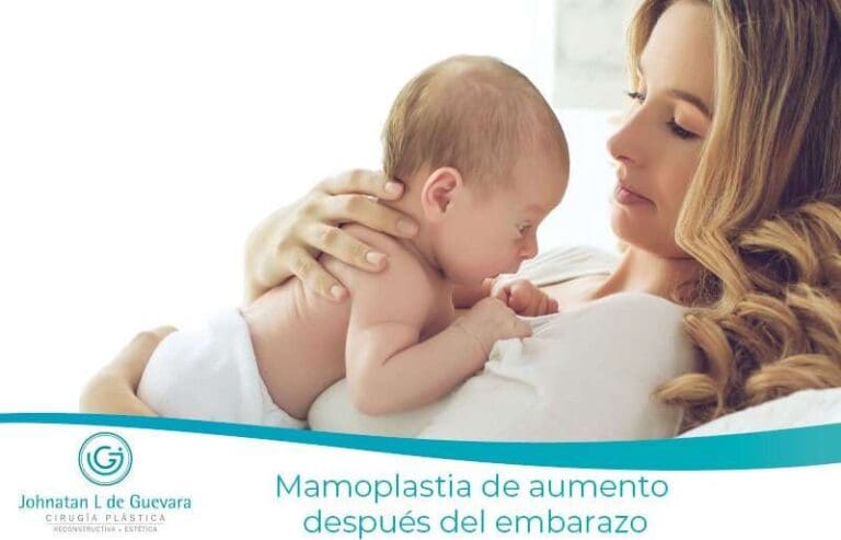 Mamoplastia de aumento después del embarazo 6 Mamoplastia de aumento después del embarazo