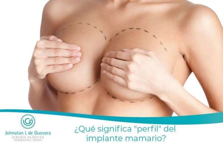 ¿Qué significa "perfil" del implante mamario? 3 ¿Qué significa "perfil" del implante mamario?