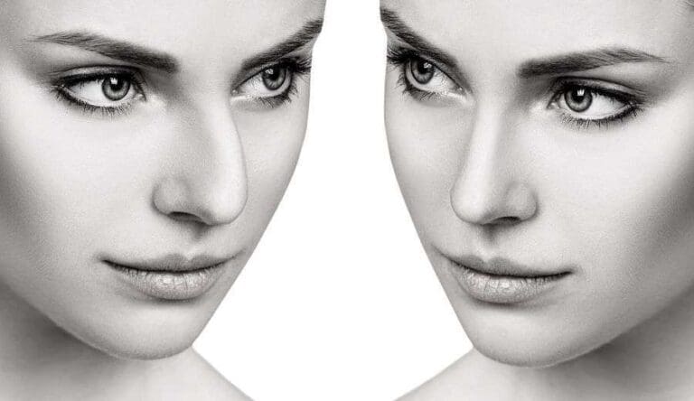 edad minima rinoplastia