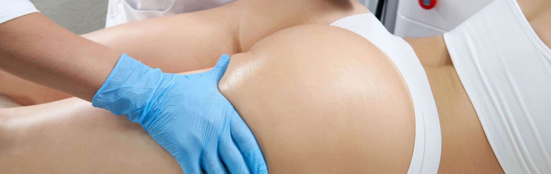 Lipoinyeccion Glutea E - Gluteoplastía en Bogotá